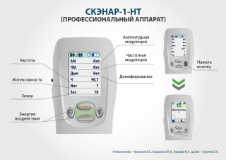 СКЭНАР-1-НТ (исполнение 01)  в Искитиме купить Медицинская техника - denasosteo.ru 